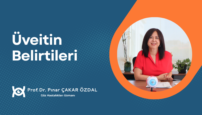 Üveit tedavisi, göz muayenesi, bilgilendirici video